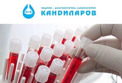 Хормонални изследвания на щитовидната жлеза:  TSH за 9 лв. ИЛИ TSH + FT4 само за 15.90 лв. от СМДЛ Кандиларов