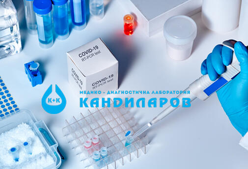 НОВО! Тест за АНТИТЕЛА SARS-CoV-2 S – IgG на Roche с висока чувствителност САМО за 28 лв. от СМДЛ Кандиларов